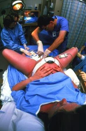 妇科阴道检查视频,直观解析女性私密健康检查过程